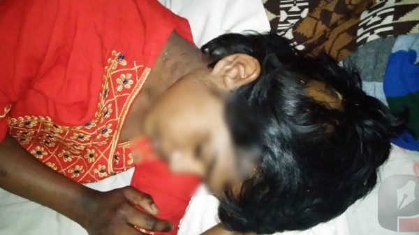 চিকিৎসকের বাসায় গৃহকর্মীকে নির্যাতন, হাসপাতালে ভর্তির পর নিখোঁজ