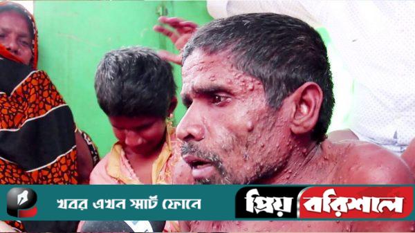 ৫০ টাকায় হুইলচেয়ার ভাড়ায় এনে চলছেন তারা